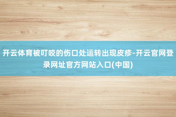 开云体育被叮咬的伤口处运转出现皮疹-开云官网登录网址官方网站入口(中国)